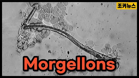 호흡에 반응하는 모겔론스 Morgellons that respond to breathing