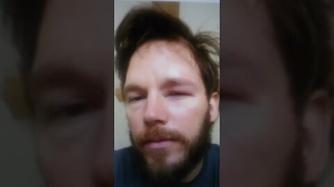 Chris Pratt Lost A Battle to Bees