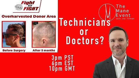 Hair Transplant Doctor or Technicians? The Mane Event - Wednesday, August 23rd