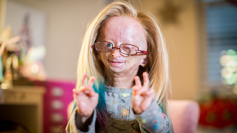 Adalia Rose: The Girl Who Ages Too Fast | BORN DIFFERENT