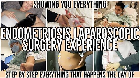 ENDOMETRIOSIS LAPAROSCOPIC EXCISION SURGERY EXPERIENCE 2021 | SURGERY #2 | SHOWING IT ALL | ez tingz