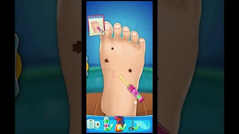 foot doctor care | Foot Surgery Doctor Gameplay Walkthrough | Lazoo games