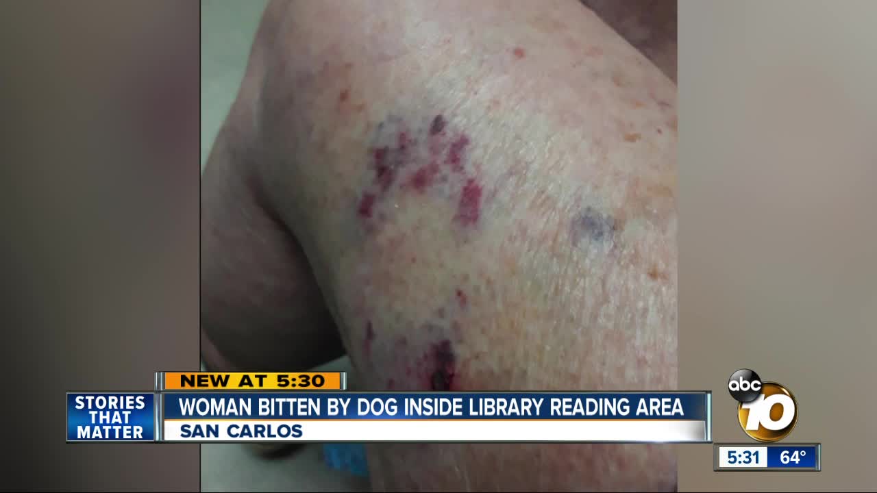 Woman bitten by dog inside public library