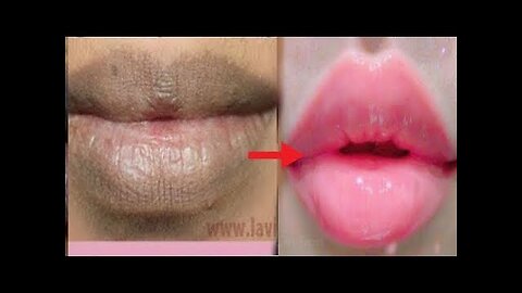 Get Soft Pink Lips Naturally _ Simple Way at Home - 100% Work