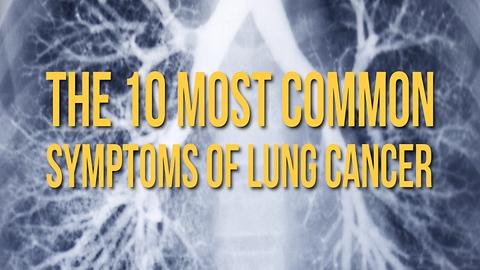 The 10 Most Common Symptoms of Lung Cancer