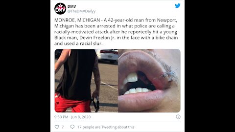 N-Word-Spewing Racist Is Indicted For Beating Black Teen With A Bike Lock As Hate Crimes G