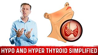 Hyperthyroid vs Hypothyroid Explained By Dr. Berg