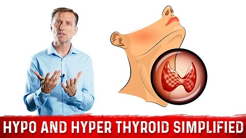 Hyperthyroid vs Hypothyroid Explained By Dr. Berg