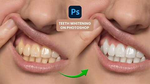 Quick and Easy Tutorial on How To Whiten Teeth In Photoshop - Teeth Whitening Tutorial