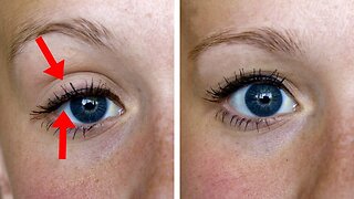 Apply This Mixture To Get Rid Of Tired Eyes And Droopy Eyelids