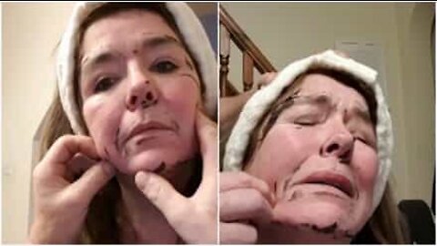 Den här mormorn gjorde allt för att få bort ansiktsmasken som fastnat