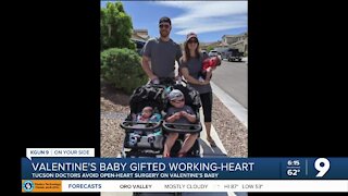 Tucson doctors avoid open-heart surgery on Valentine's baby