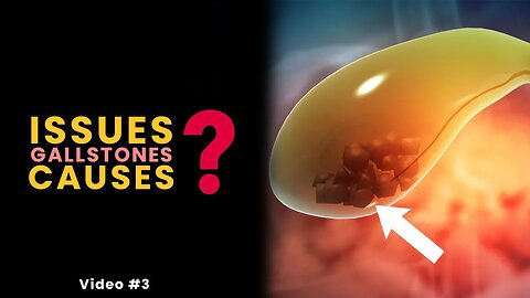 What Problems do Gallstones Cause? || Video #3