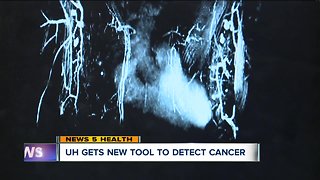 Game-changing new tool at University Hospitals helps detect breast cancer sooner