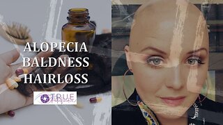 ALOPECIA, BALDNESS, HAIR LOSS - CAUSES AND SOLUTIONS | True Pathfinder