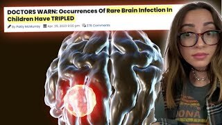 RARE Brain issue in Kids...