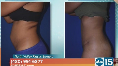 North Valley Plastic Surgery offers a tummy tuck that promises amazing results