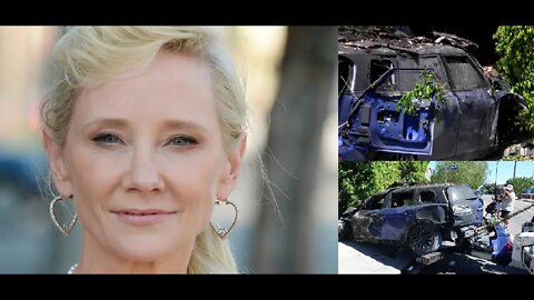 Hard to Kill Anne Heche IN Stable Condition After Multiple Crashes