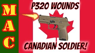 Sig P320 Discharge Wounds Canadian JTF-2 Operator!