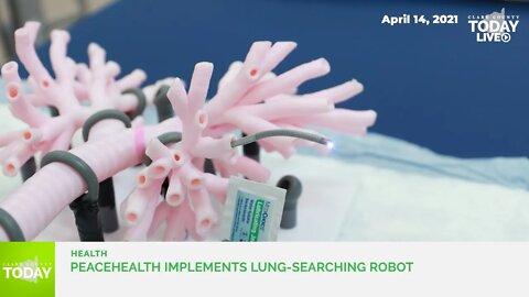 PeaceHealth implements lung-searching robot