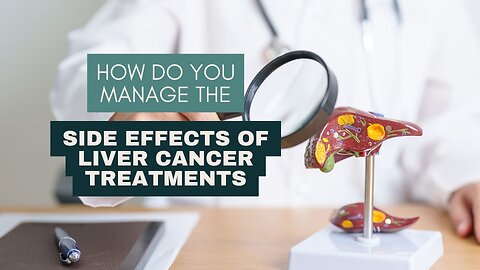 How Do You Manage the Side Effects of Liver Cancer Treatments?