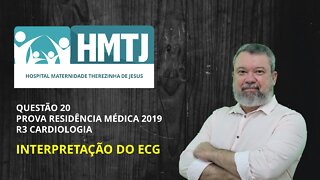 QUESTÃO RESIDÊNCIA MÉDICA 2019 HMTJ - INTERPRETAÇÃO ECG