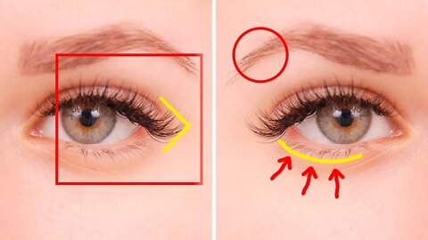 5 Things Your Eyes Are Trying To Tell You About Your Health