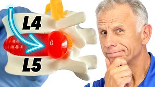 How to Fix Sciatica (Back Pain) in Older Adults