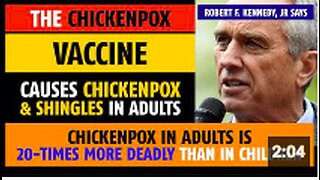 Chickenpox vaccine causes chickenpox and shingles in adults, notes Robert F. Kennedy, Jr