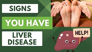 Your Hands and Feet Speak Louder Than Words: Understanding Liver Warning Signs