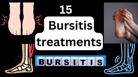 15 Bursitis treatments