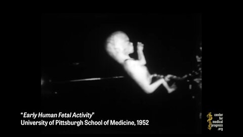 Pitt's Barbaric Experiments on Infants go back to 1930s