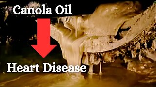 Never Use Seed Oils - Cholesterol Myth Debunked - What Really Causes Heart Disease?