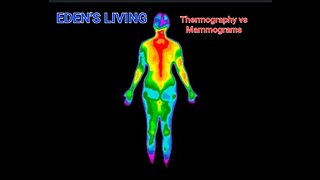 Thermography vs Mammograms
