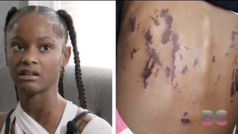 12-year-old girl charged in acid attack against 11-year-old at Detroit park