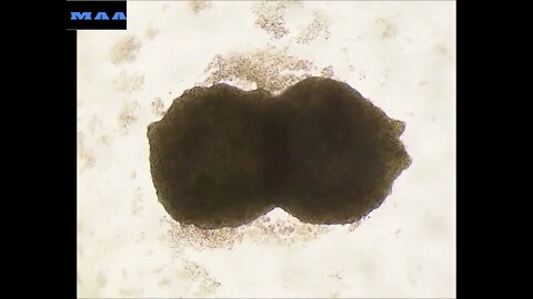 Pulmonary Cardiac Regeneration_Dr. Mattapally