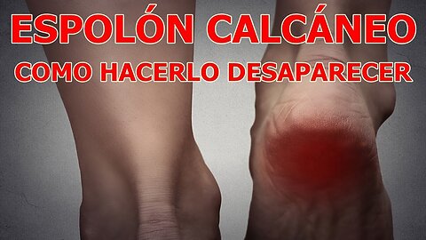 ESPOLON CALCANEO BIODESCODIFICACION Y COMO HACERLO DESAPARECER