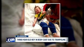 Three-year-old boy injured due to trampoline-related injury