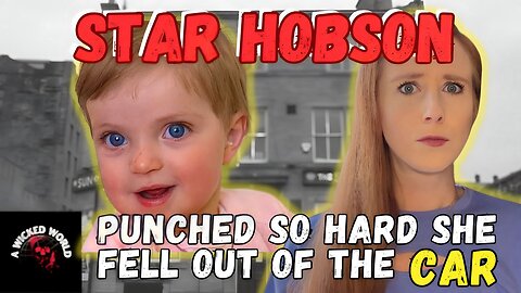 Mom’s Boxer Girlfriend Made Her the Punching Bag- The Story of Star Hobson