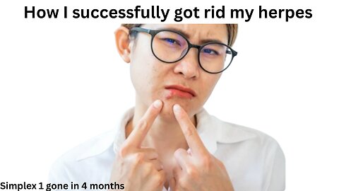 How I got rid of my herpes simplex 1 in 4 months