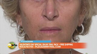 Plexaderm Valentine’s Day special for AM Buffalo viewers