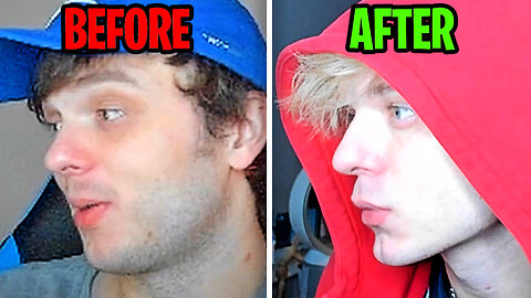 How I Got A More Defined Jawline (Looksmaxxing)