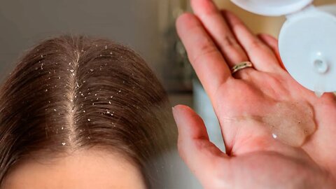 COMO FAZER UM SHAMPOO NATURAL ANTICASPA EM CASA