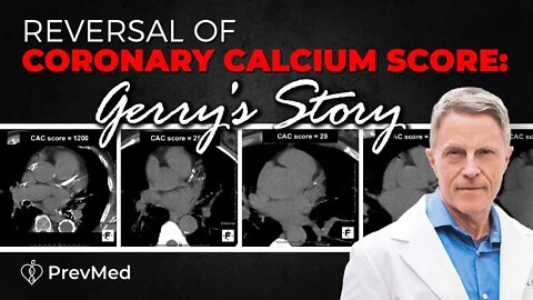 Reversal of Coronary Calcium Score: Gerry's Story