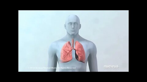 Opciones de tratamiento para cáncer de pulmón
