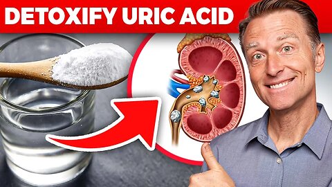 The Ultimate Kidney Cleanse for Uric Acid and Gout: Dr. Berg's Proven Techniques