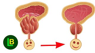 KEEP YOUR PROSTATE HAPPY - Here are some foods to eat and which to avoid