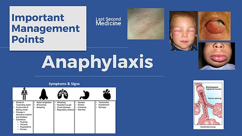 ANAPHYLAXIS - The Long & Short of it! :)