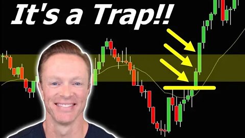 🔥 TRAP ALERT!! This Non-Farm Payroll 'Trap' Could Be Biggest Trade of Week!!