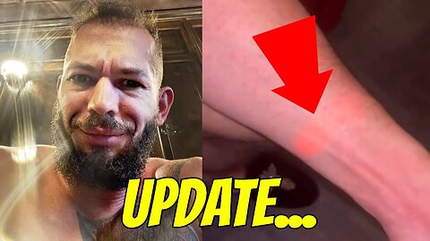 Andrew Tate Health UPDATE After BAD Reaction